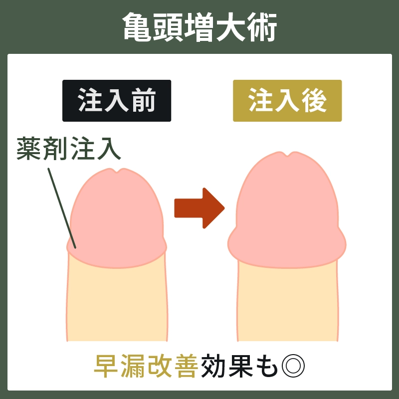 切らない長径治療について