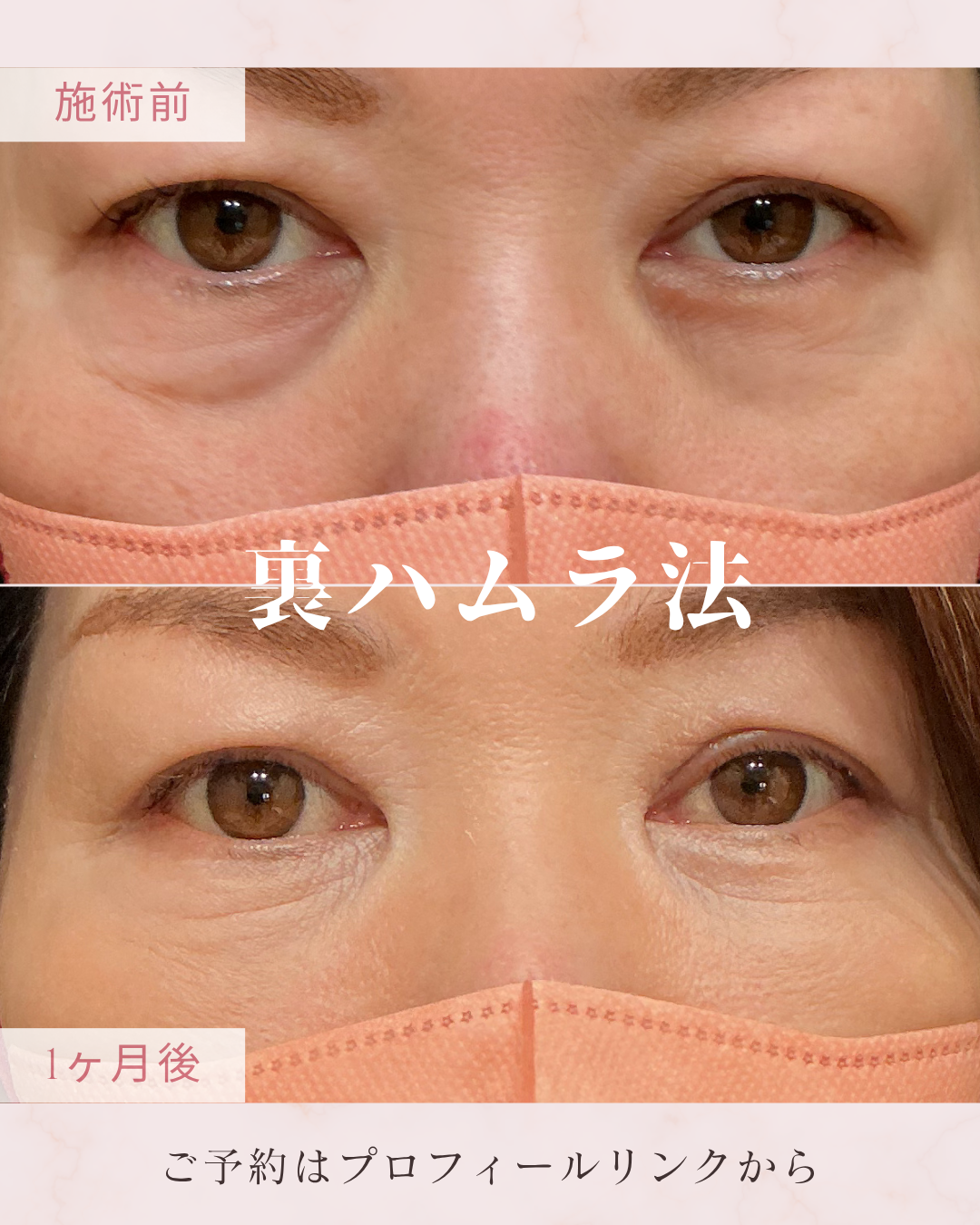 施術名の症例写真