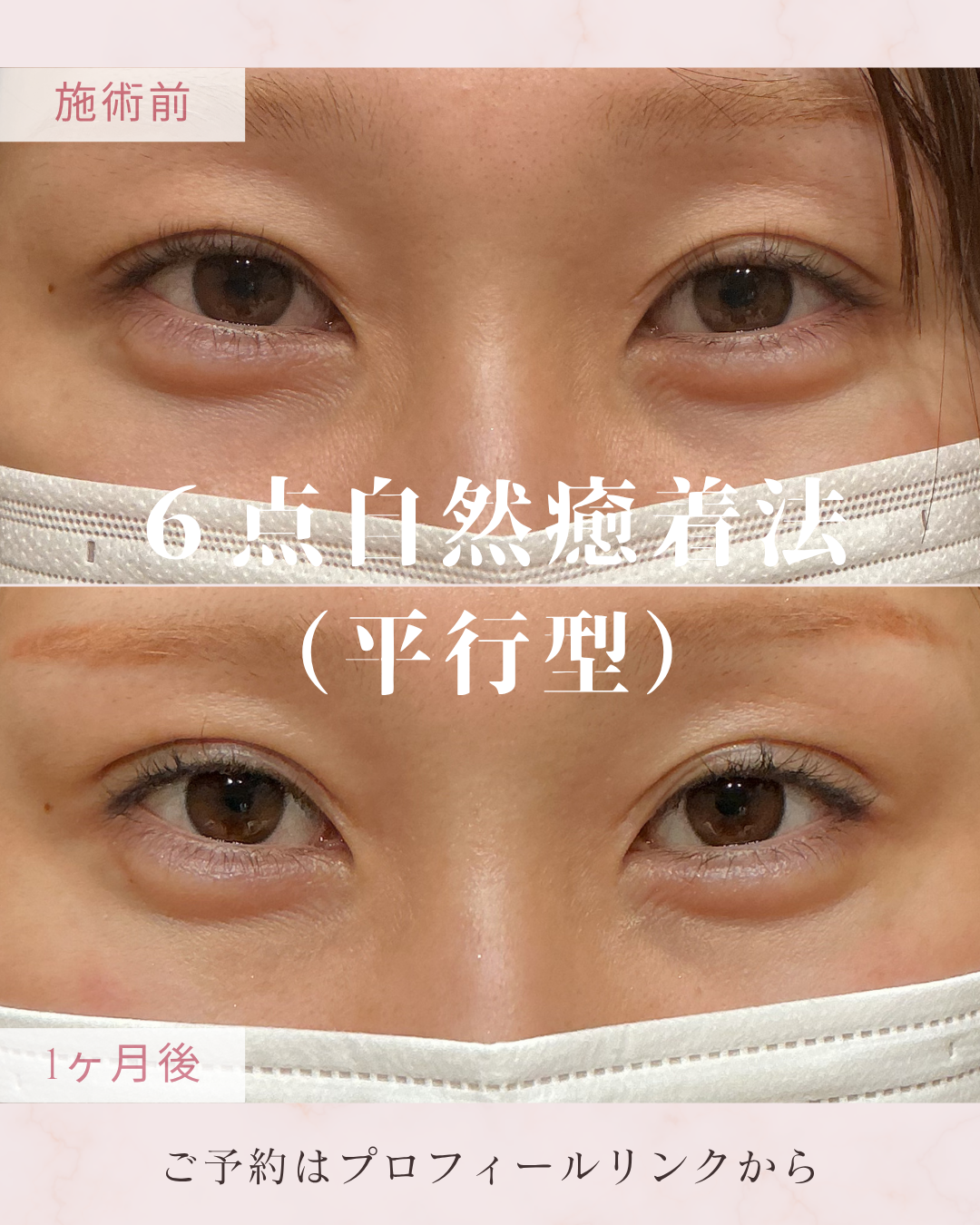 施術名の症例写真