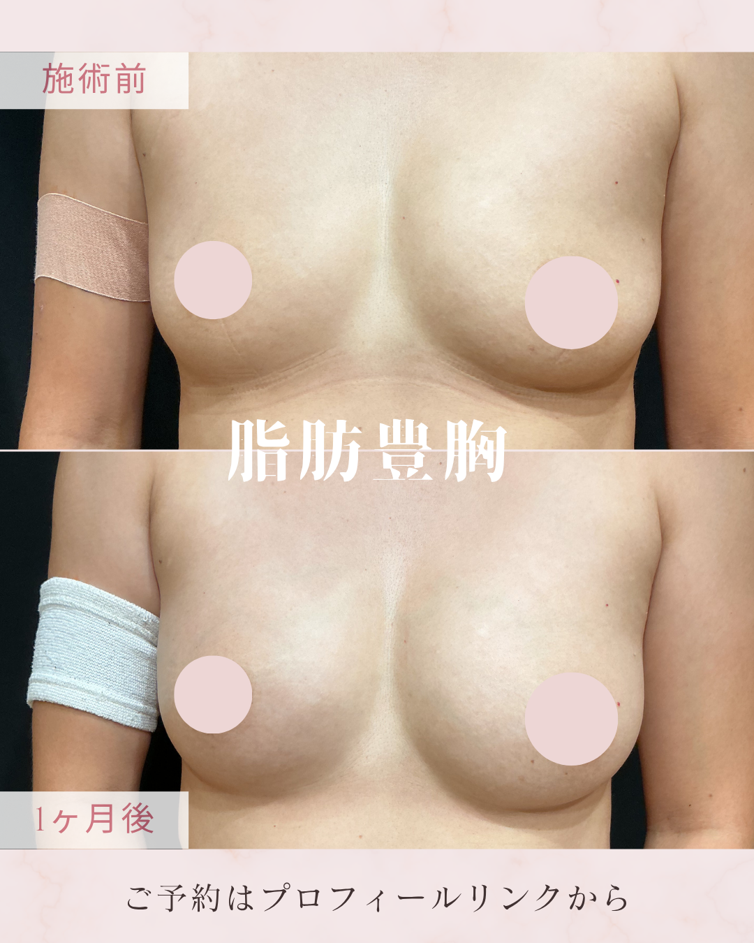 施術名の症例写真