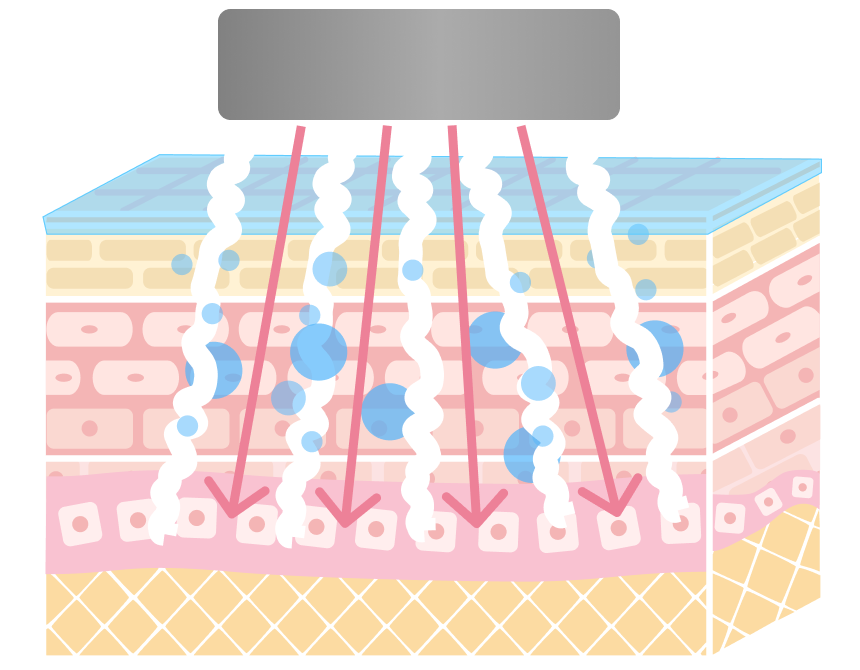 エレクトロポレーション