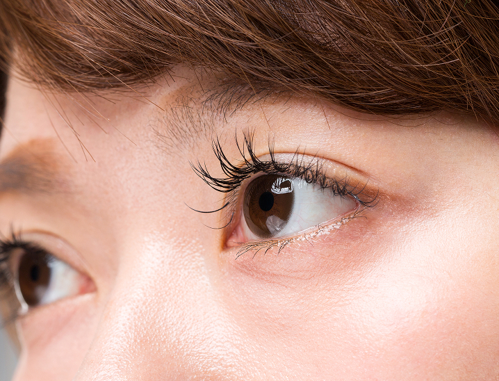 二重切開について