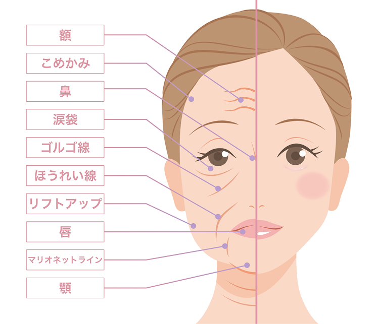 注入可能な部位