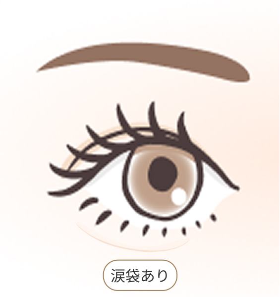涙袋あり