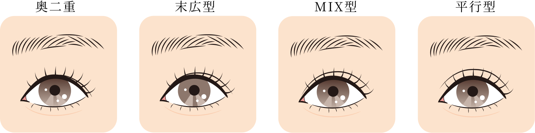 二重の種類（奥二重・末広型・MIX型・平行型）