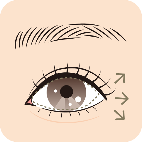 韓流靭帯移動 After