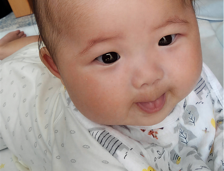 舌癒着症について