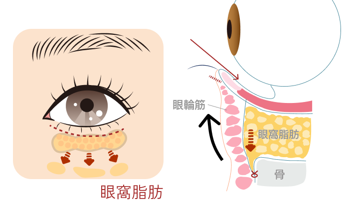 表ハムラ施術後