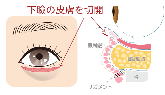 表ハムラ施術前