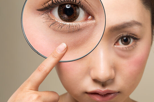 姫路でクマ取りをお考えの方へ｜治療法・費用・ダウンタイムを徹底解説