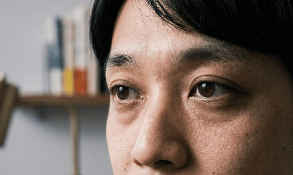 姫路でメンズの切らないクマ取りはアデル美容クリニック｜男の目の下のたるみ・疲れ顔解消